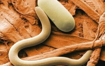 Types of contact parasites in the human body