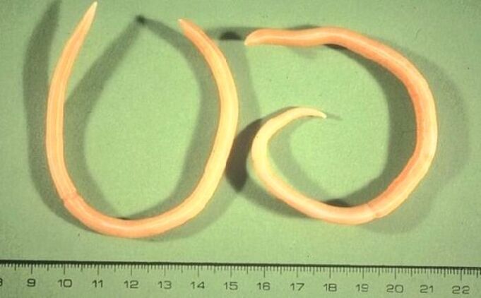 pink worm from the human body