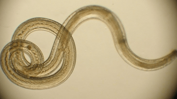 parasitic worms from the human body
