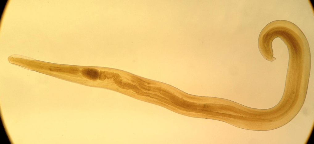 Penworm is a common parasite in children. 